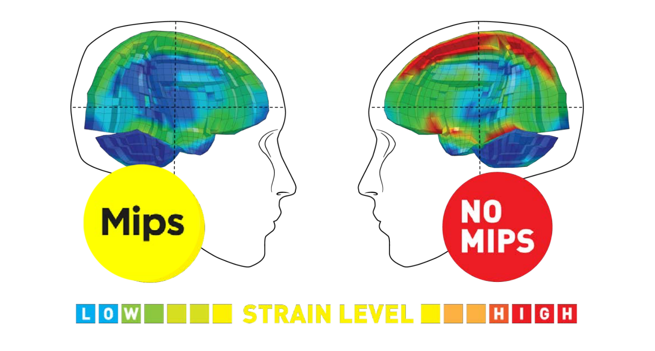 Illustration of strain