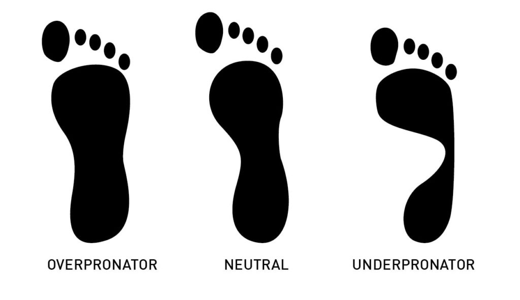 Illustration of different feet types