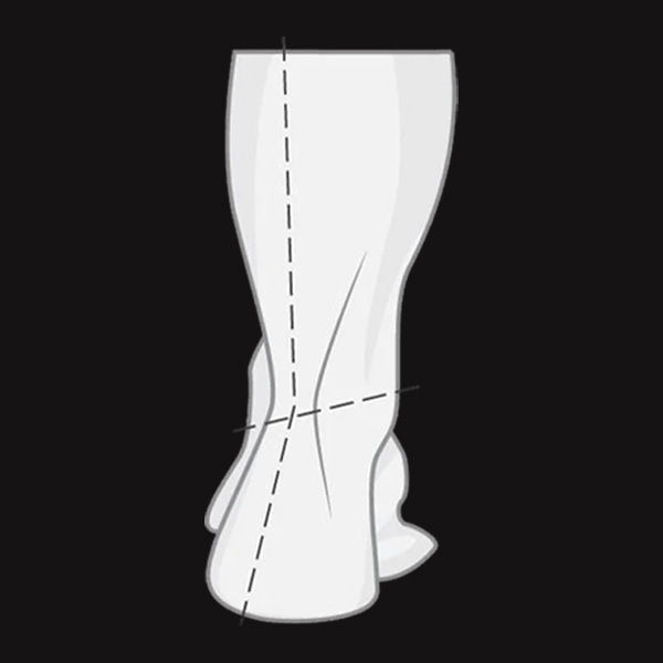 Supination (Underpronation) illustration. 